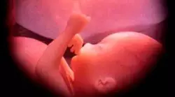 Apoyo al aborto cae en los EE.UU. 1 nino por nacer