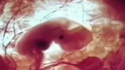 Las miles de mujeres que en Rusia están buscando revertir los efectos de la píldora abortiva 2 aborto