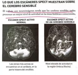 Cerebro sensible: maravillosa esponja que absorbe como nadie el universo - Neuroanatomía con agua bendita (III) 3 1 7