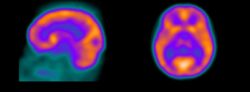 Los 6 tipos de cerebro: Neuroanatomía con agua bendita 6 3