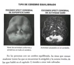Cerebro espontáneo, de innovadores: Pero pueden ser muy impulsivos – Neuroanatomía con agua bendita (IV) 3 4 5 1
