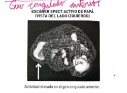 Los 6 tipos de cerebro: Neuroanatomía con agua bendita 9 5 4