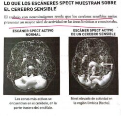 Los 6 tipos de cerebro: Neuroanatomía con agua bendita 11 7 5