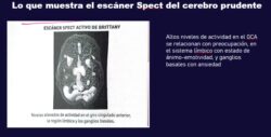 Los 6 tipos de cerebro: Neuroanatomía con agua bendita 12 8 2